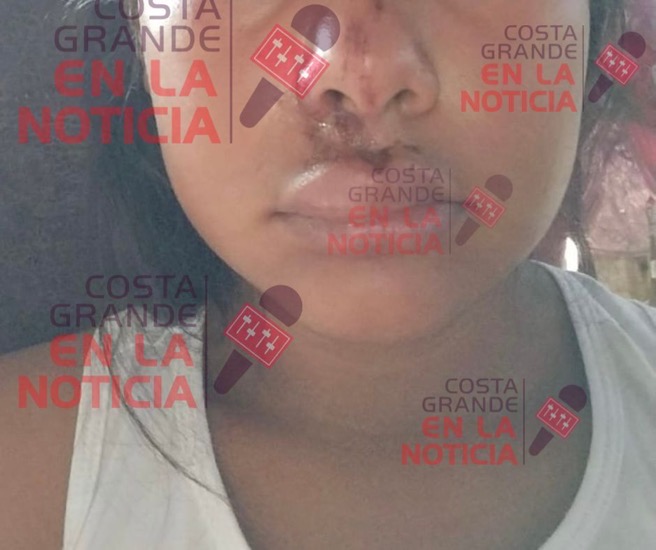 nina-zihuatanejo-agredida-primaria-barrio-viejo_.jpg nina-zihuatanejo-agredida-primaria-barrio-viejo_.jpg