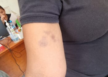 Intendente de secundaria, agrede a maestra y alumna