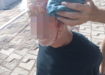 Se lesiona turista extranjero en puente de La Marina