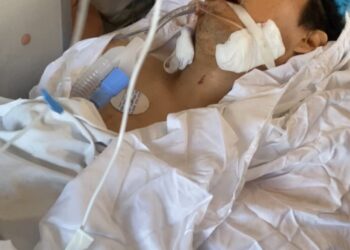 Solicitan apoyo para hombre en estado crítico tras accidente en Zihuatanejo