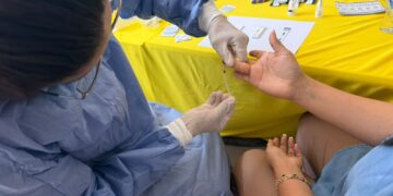 SSG intensifica acciones de detección y prevención en el Día Mundial contra la Hepatitis
